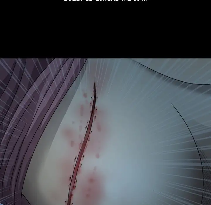 Disfigured - Chapter 4 [photo 32] - MangaPorn